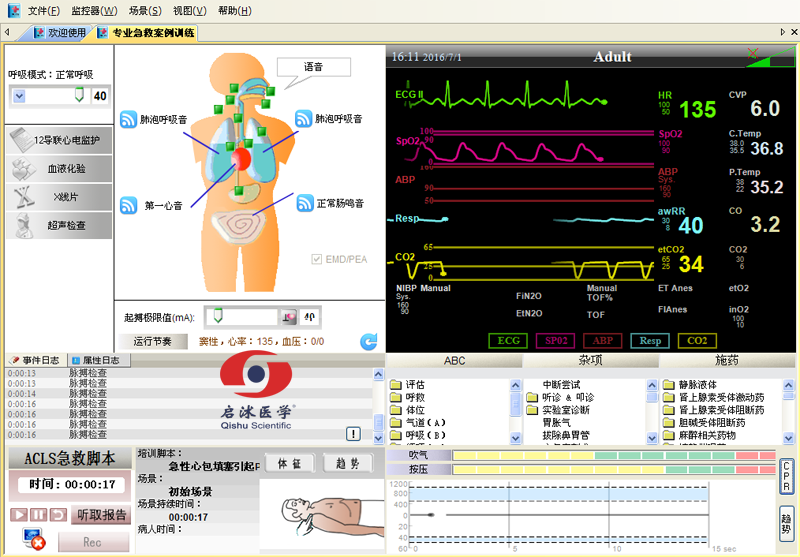 高智能數(shù)字化綜合急救技能訓(xùn)練系統(tǒng)（ACLS高級(jí)生命支持、計(jì)算機(jī)軟件控制）